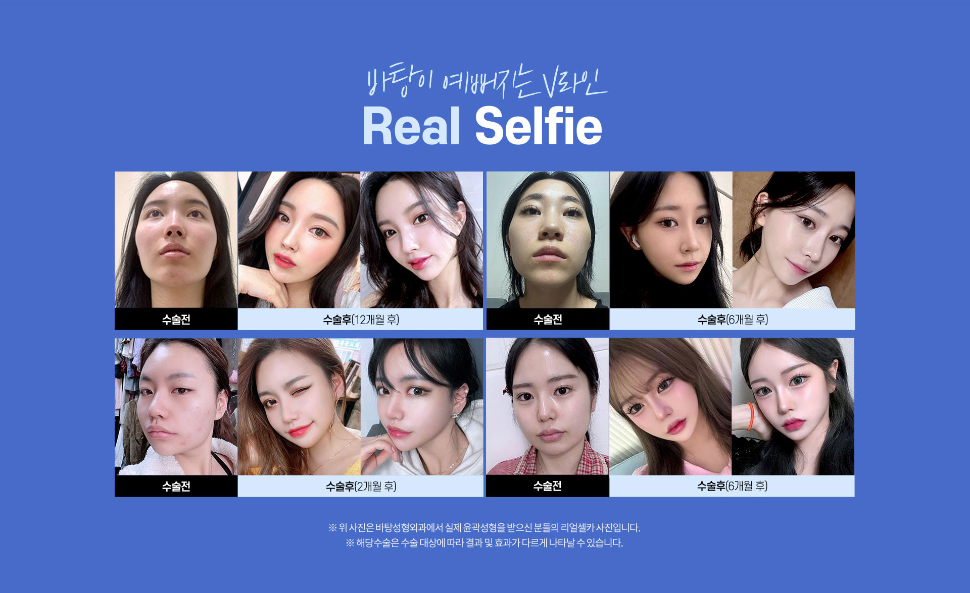 바탕이예뻐지는V라인,리얼셀피