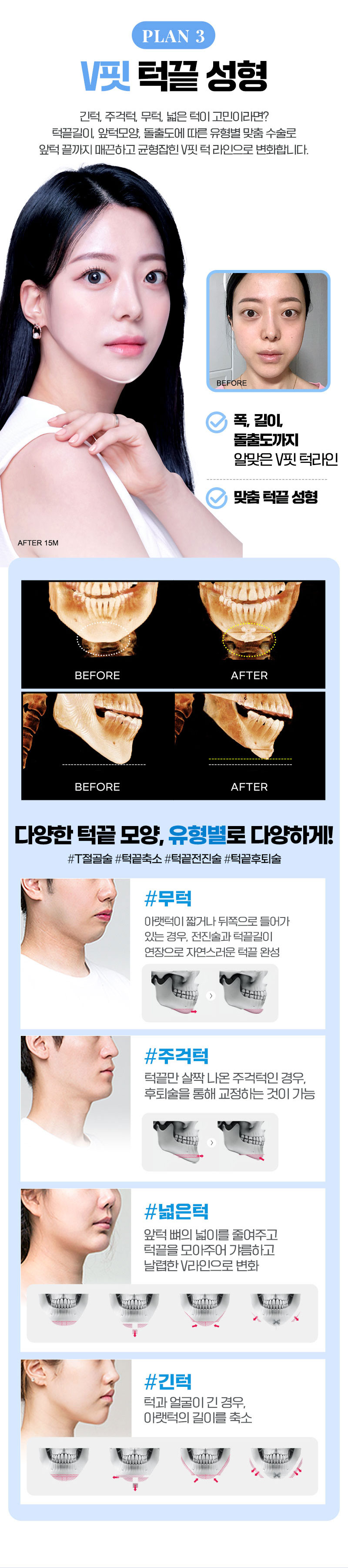 바탕이예뻐지는V라인,리얼셀피