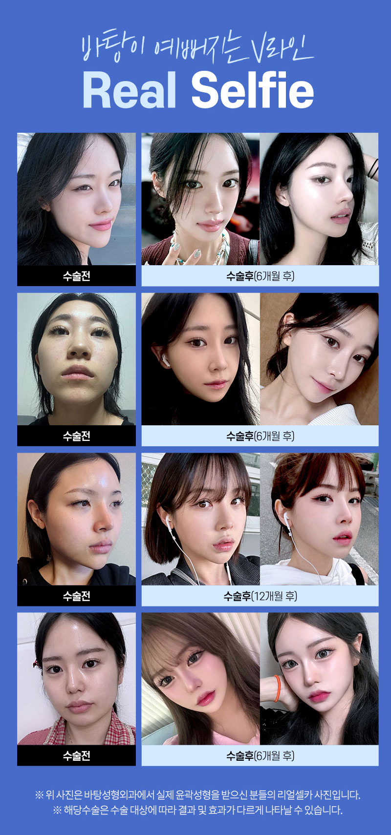 바탕이예뻐지는V라인,리얼셀피