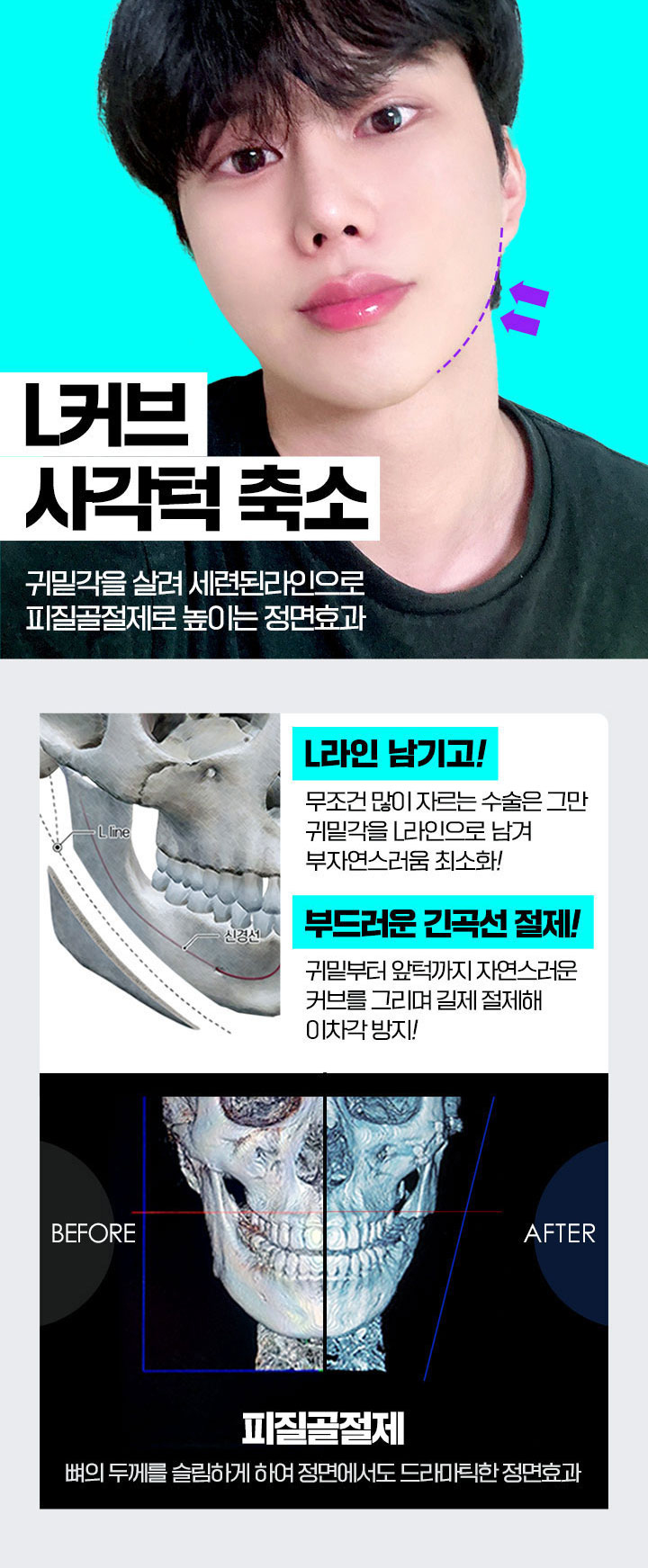 바탕 안면윤곽