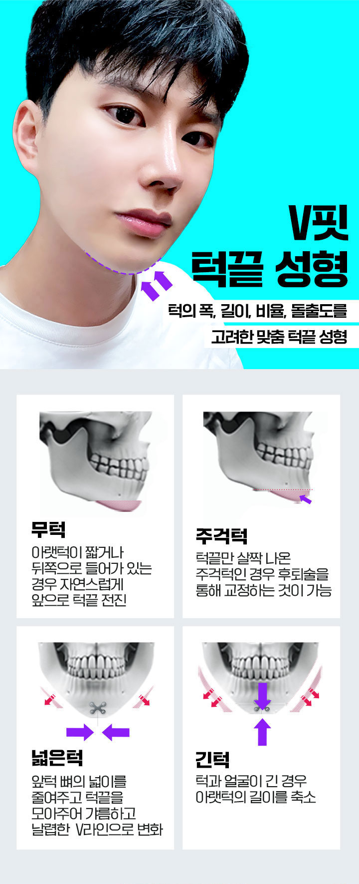 바탕성형외과 남자성형
